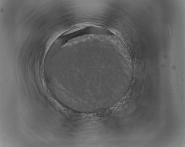 X0000074010289200609111630