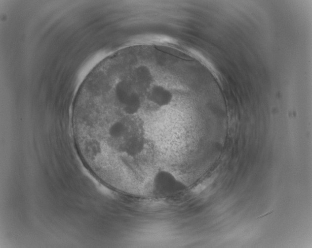 X0000074011103200609111617