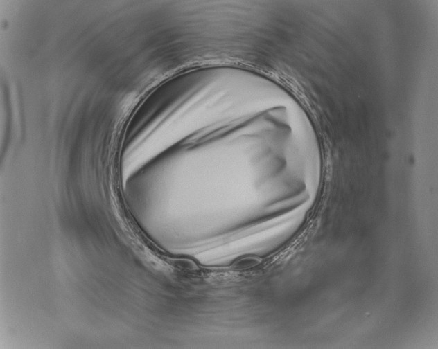 X0000074020145200609111657