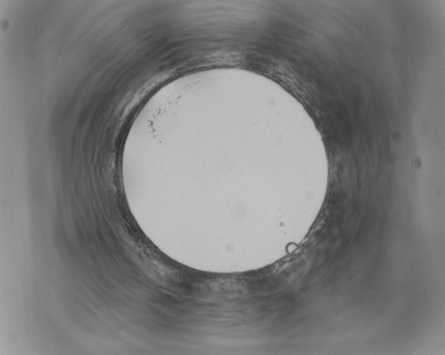 X0000074020146200609111657