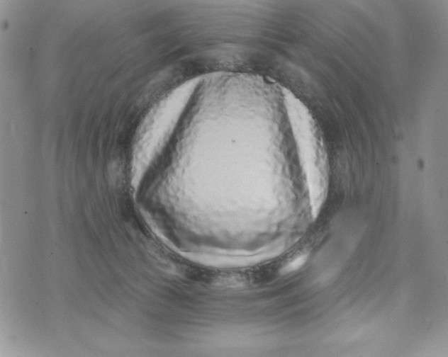 X0000074020177200609111658