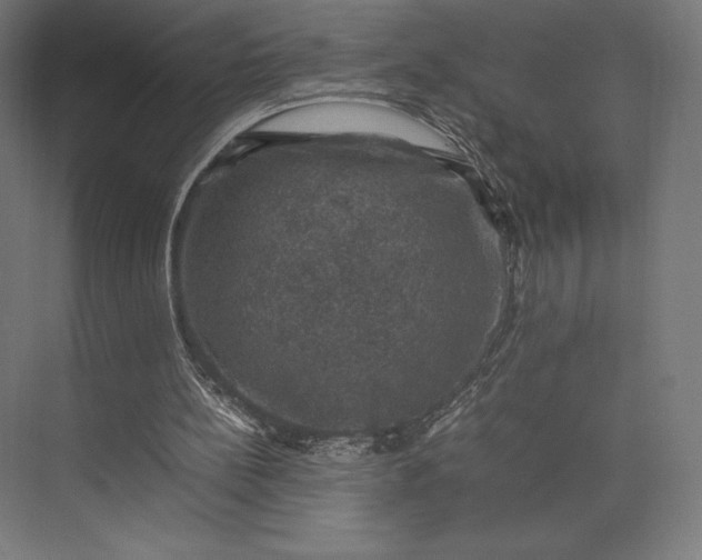 X0000074030148200609061150