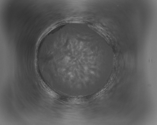 X0000074030293200609061149