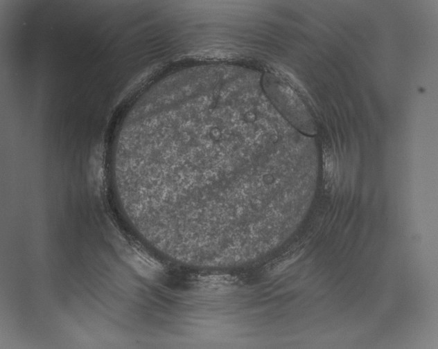 X0000074030396200609061147