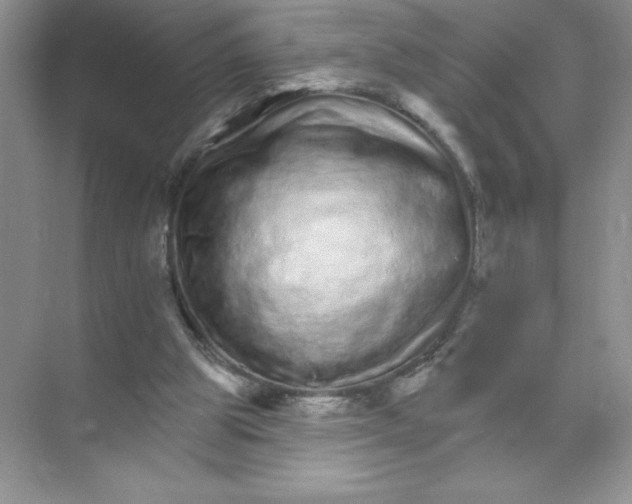 X0000074220153200609222016