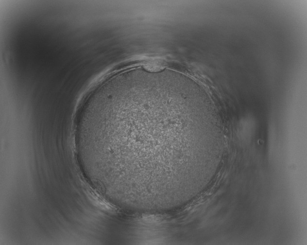 X0000074260149200609011351