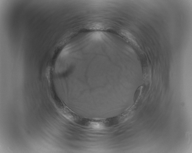 X0000074290167200609222318