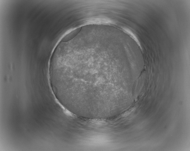 X0000074291103200609222302