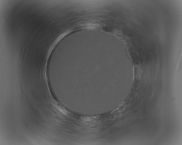 X0000074970147200609011225