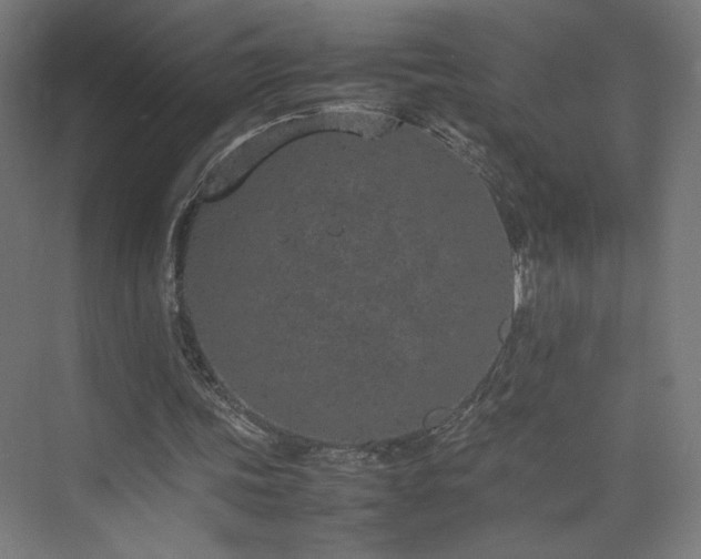 X0000074970339200609011221