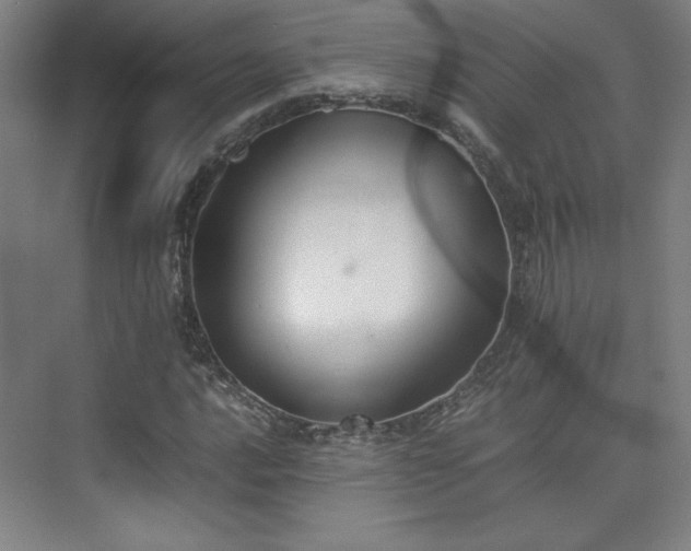 X0000074971016200609011210