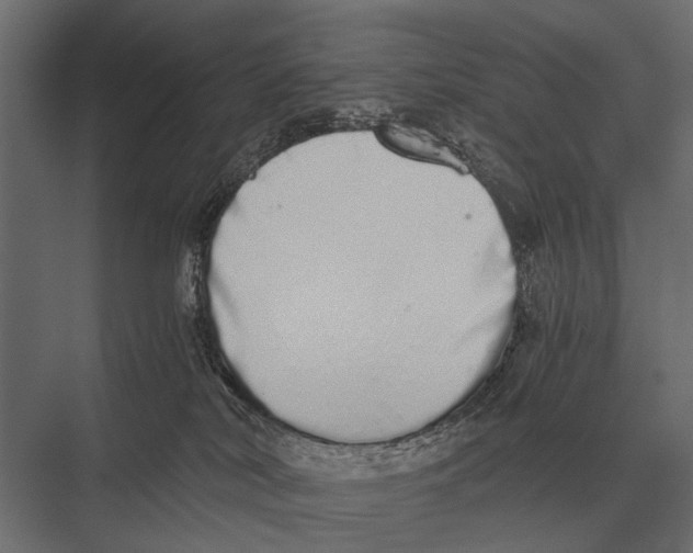 X0000075330038200610061639