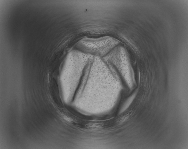 X0000075330117200610061638