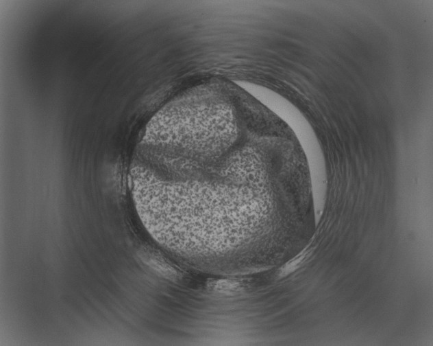 X0000075330180200610061637