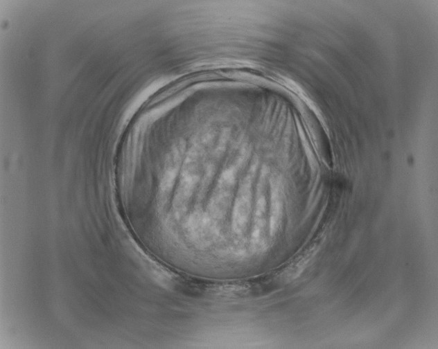 X0000075361187200609251054