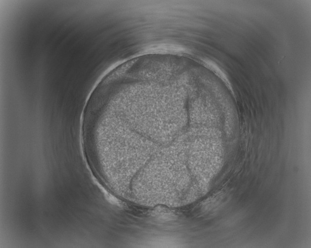 X0000075361103200610061740