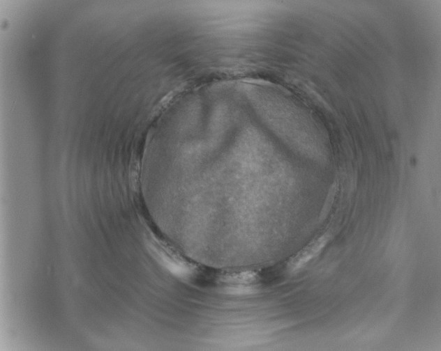 X0000075380576200609251155