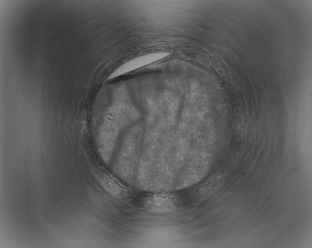 X0000075380758200610061838