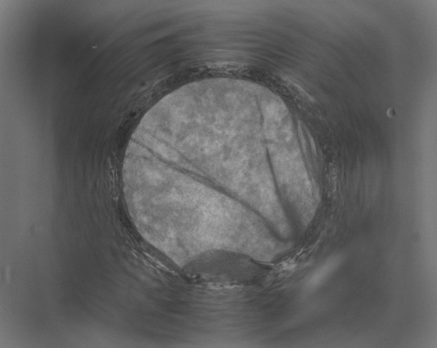 X0000075380917200610061835