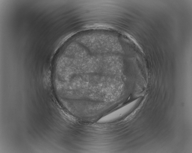 X0000075381066200610061833