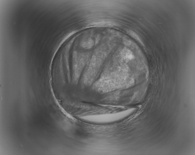 X0000075381087200610061832