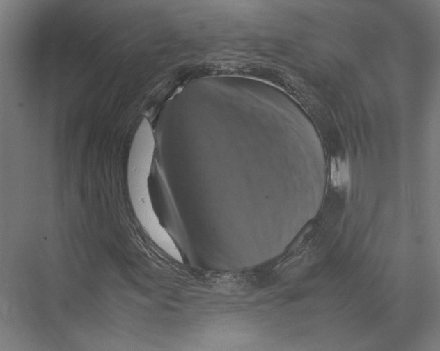 X0000075381155200610061831