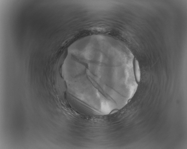 X0000075381297200610061828