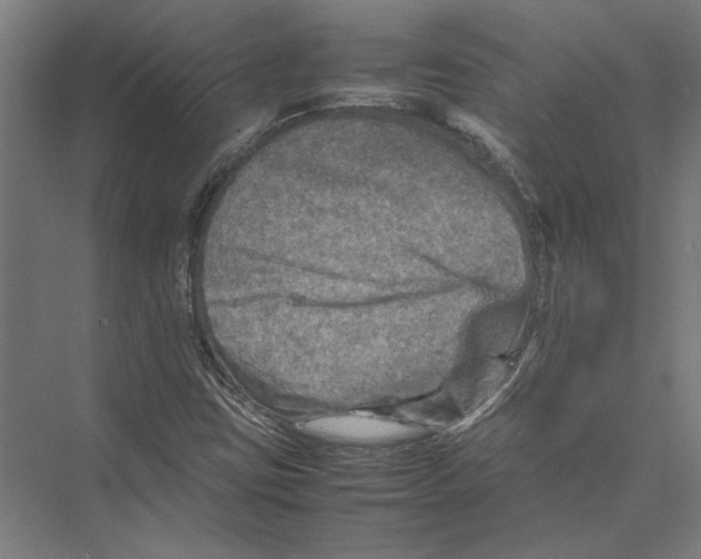 X0000075381403200610061827