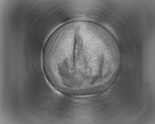 X0000075381476200610061826