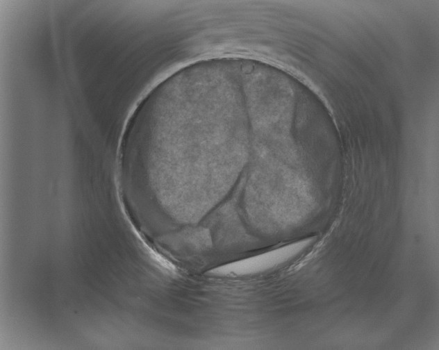 X0000075381525200610061825