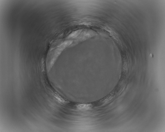 X0000075400465200609251023