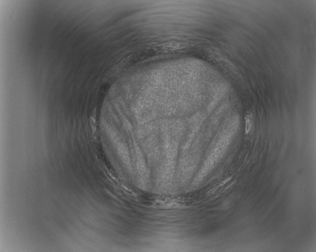 X0000075401011200610061925