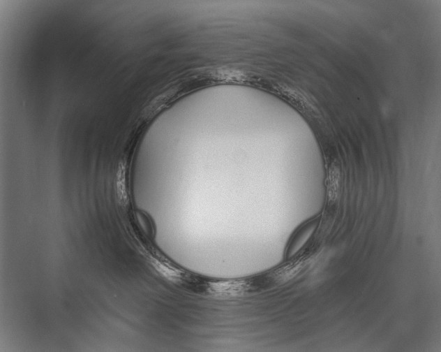 X0000075410238200610062005