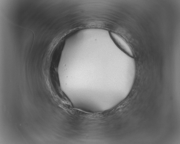 X0000075410241200610062005