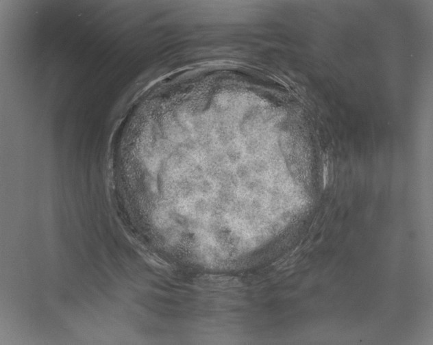 X0000075410339200610062003