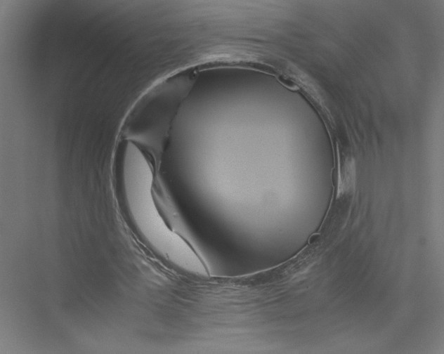 X0000075410387200610062003