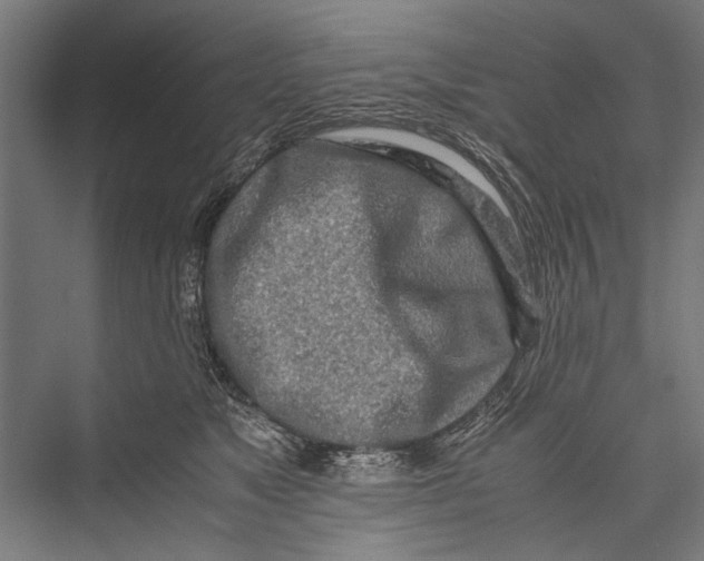 X0000075410517200610062001