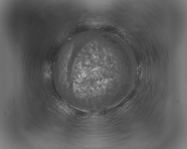 X0000075811204200609151138