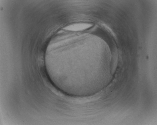 X0000075810017200610061743