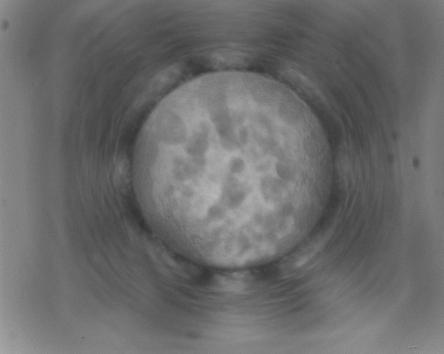 X0000075810079200610061742