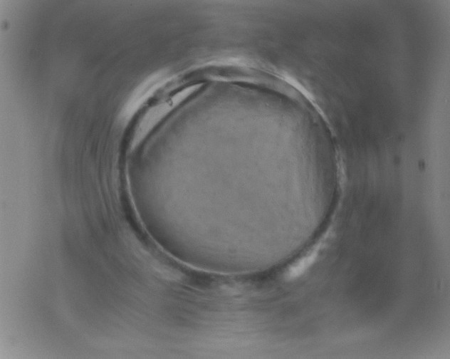 X0000075810199200610061740