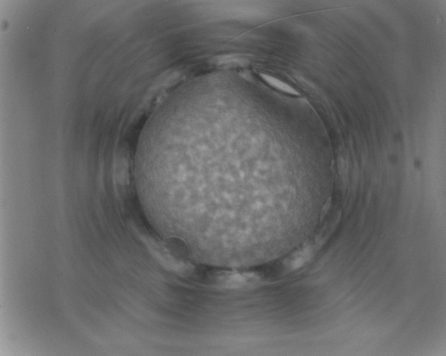 X0000075810379200610061738