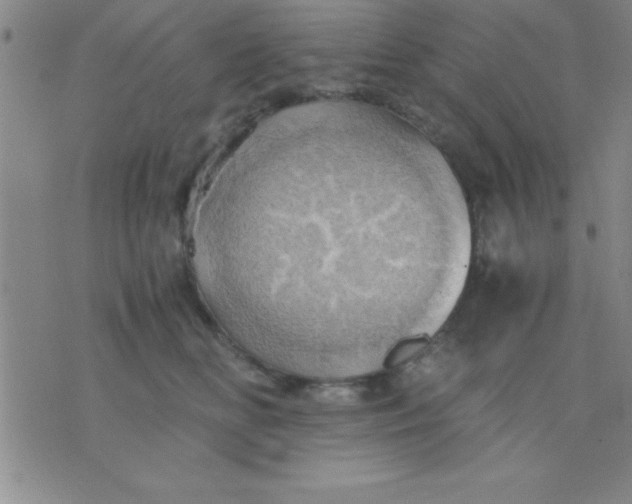 X0000075810518200610061735