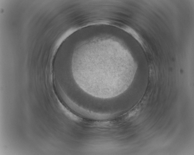 X0000075811143200610061725