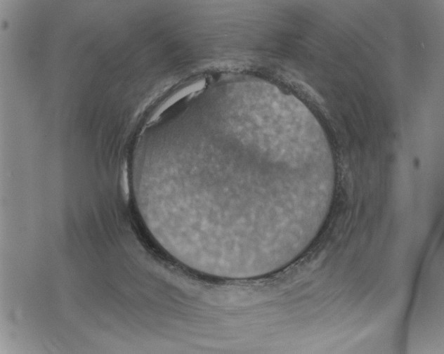 X0000075810020200610151441