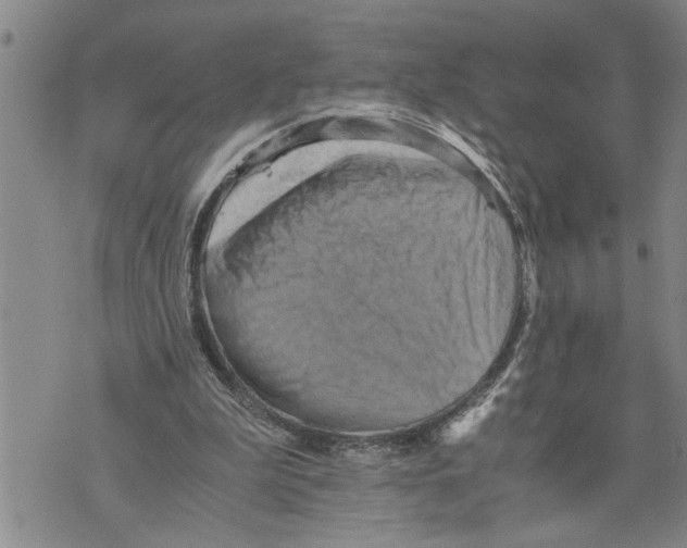 X0000075810199200610151438