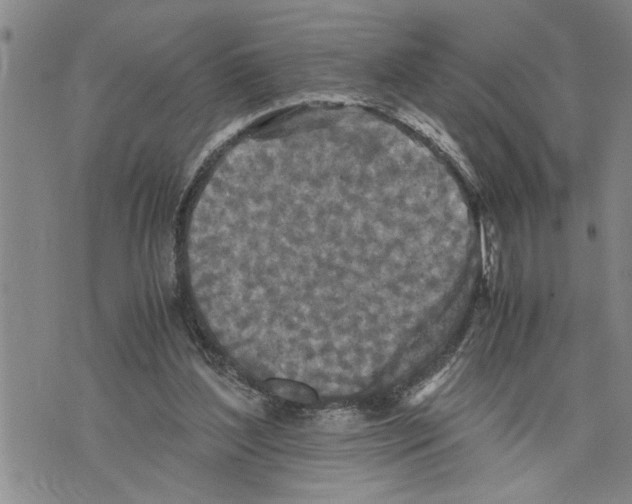 X0000075810204200610151438