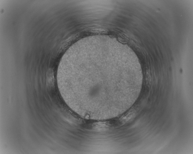 X0000075810320200610151436