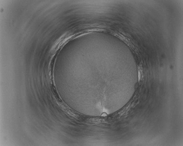 X0000075810339200610151435