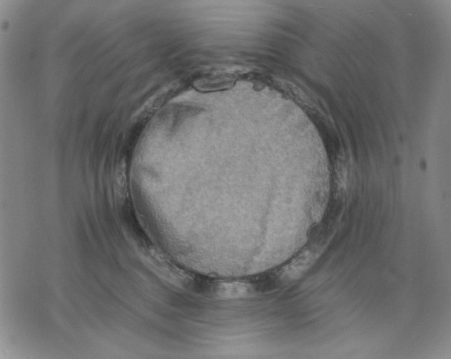 X0000075810376200610151436